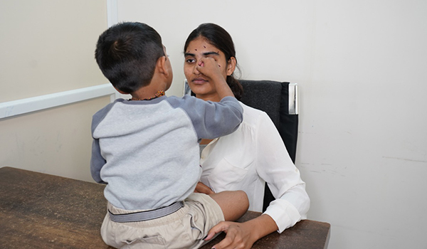 vision therapy